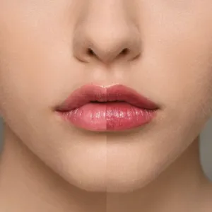 Chogan Supreme Lip Treatment – малина